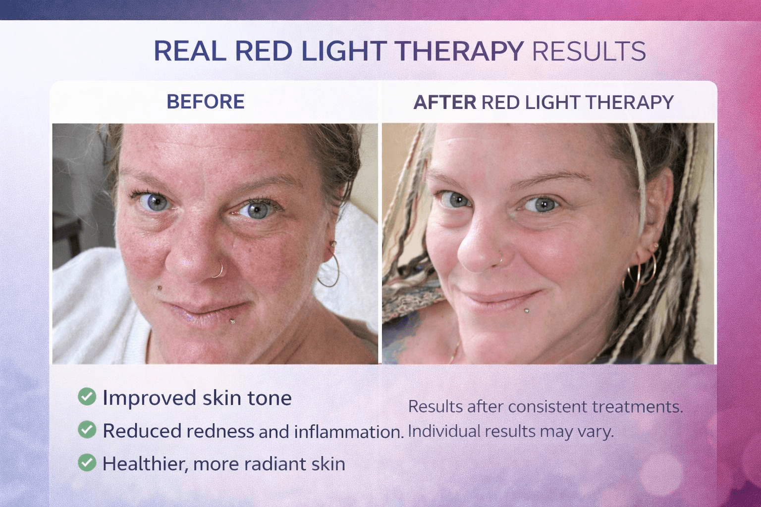 Real Red Light Therapy results - before and after